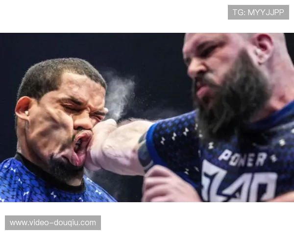 神经科专家警示扇耳光比赛或严重危害参与者脑部健康 神经科专家警示扇耳光比赛或严重危害参与者脑部健康